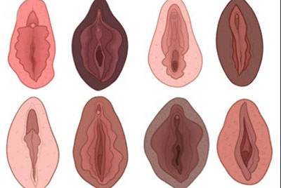  انواع واژن زنان, شکل انواع واژن
