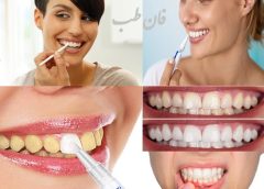 مزایای استفاده از قلم سفید کننده ی دندان, روش استفاده از لاک سفید کننده ی دندان,لاک سفید کننده دندان چیست,دندان,دندان سفید,tooth whitening varnish,