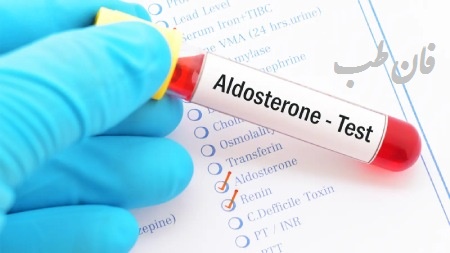 آزمایش آلدوسترون (ALD), درباره آزمایش آلدوسترون (ALD), نحوه انجام آزمایش آلدوسترون (ALD), زمان انجام آزمایش آلدوسترون (ALD), آزمایش آلدوسترون (ALD) چیست, نام های دیگر آزمایش آلدوسترون (ALD), نحوه انجام آزمایش آلدوسترون (ALD), خطرات و عوارض آزمایش آلدوسترون (ALD), زمان و شرایط انجام آزمایش آلدوسترون (ALD), موارد تجویز آزمایش آلدوسترون (ALD), داروهای مداخله گر آزمایش آلدوسترون (ALD), داروهای تاثیرگذار بر آزمایش آلدوسترون (ALD), تفسیر آزمایش آلدوسترون (ALD), مقادیر نرمال آزمایش آلدوسترون (ALD), نکاتی برای انجام آزمایش آلدوسترون (ALD),آزمایش آلدوسترون (ALD), درباره آزمایش آلدوسترون (ALD), نحوه انجام آزمایش آلدوسترون (ALD) , زمان انجام آزمایش آلدوسترون (ALD) , آزمایش آلدوسترون (ALD) چیست, نام های دیگر آزمایش آلدوسترون (ALD) , نحوه انجام آزمایش آلدوسترون (ALD), خطرات و عوارض آزمایش آلدوسترون (ALD), زمان و شرایط انجام آزمایش آلدوسترون (ALD), موارد تجویز آزمایش آلدوسترون (ALD),مقادیر نرمال آزمایش آلدوسترون (ALD),نکاتی برای انجام آزمایش آلدوسترون (ALD),داروهای مداخله گر آزمایش آلدوسترون (ALD),داروهای تاثیرگذار بر آزمایش آلدوسترون (ALD),تفسیر آزمایش آلدوسترون (ALD),