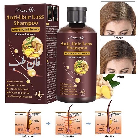 تاثیر شامپوهای ریزش مو, درمان ریزش مو با شامپوهای ضد ریزش مو, شامپو ریزش مو و محکم تر کردن ریشه مو