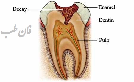 کشیدن دندان شیری, زمان کشیدن دندان شیری, عوارض کشیدن دندان شیری