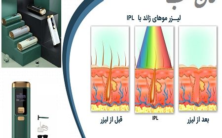 دستگاه لیزر IPL چیست؟