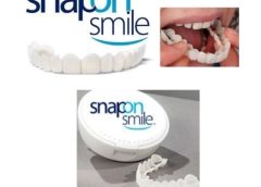لمینت متحرک دندان دو فک snap on smile کد 1497